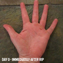 Load image into Gallery viewer, TWL - Body - Rip Repair
