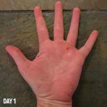 Load image into Gallery viewer, TWL - Body - Rip Repair
